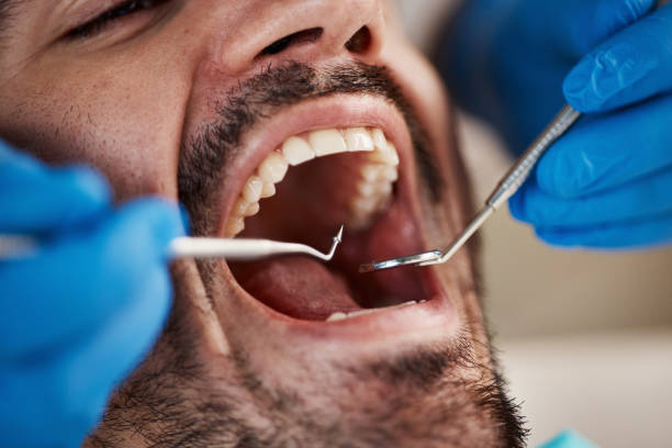 Urgent Tooth Repair in NC