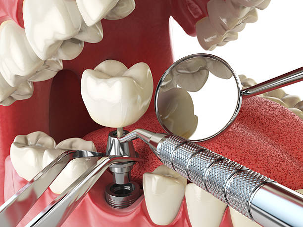 Best Urgent Tooth Repair  in Raeford, NC
