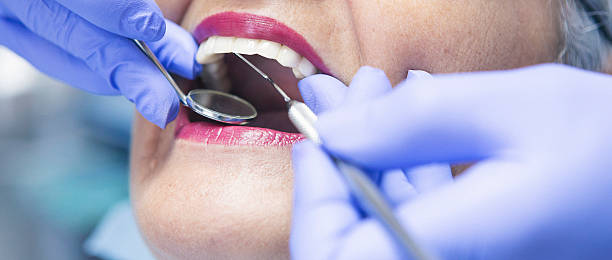 Best Teeth Whitening  in Raeford, NC